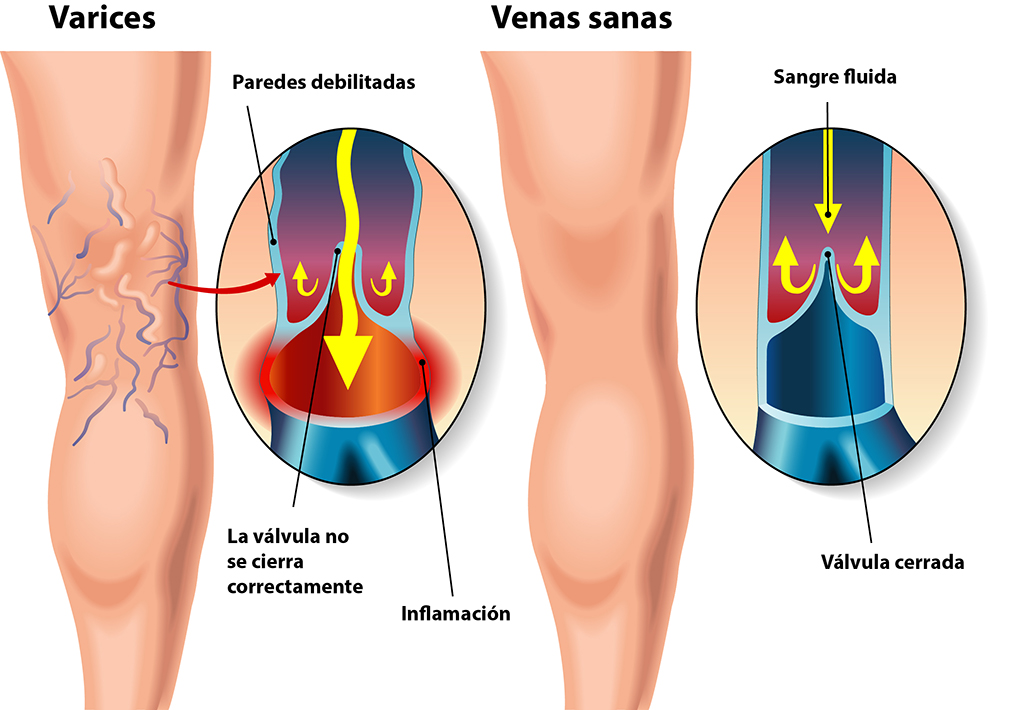 Salud y Deporte